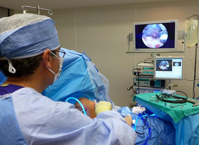 Arthroscopic surgery